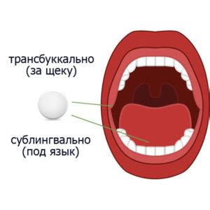 Что такое сублингвально и трансбуккально?