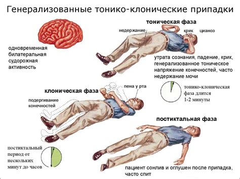 Что такое судороги при обмороке?