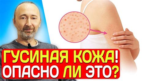 Что такое сыпь на теле и каковы её причины?