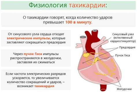 Что такое тахикардия во время операции и почему она возникает?