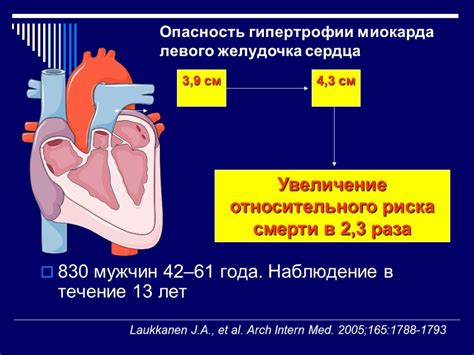 Что такое тахикардия левого желудочка?