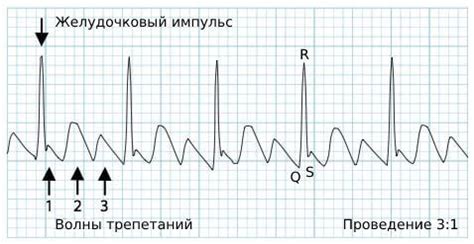 Что такое типичная форма?