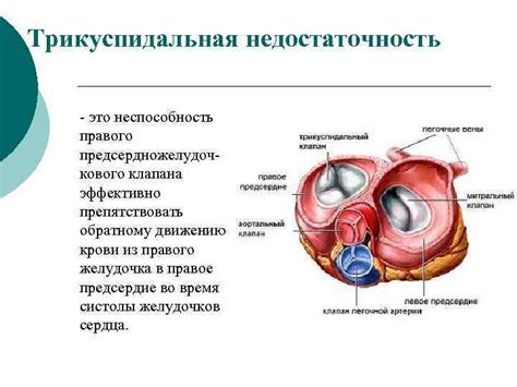 Что такое трикуспидальная регургитация?