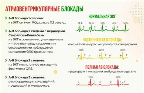 Что такое убогость и как ее определить?