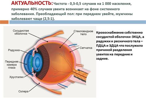 Что такое увеит глаз и как она возникает?