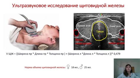 Что такое узловые образования?