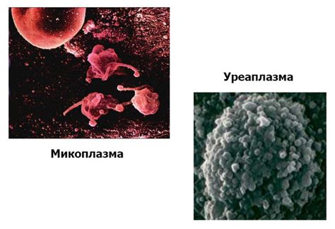 Что такое уреаплазма и как она передается?