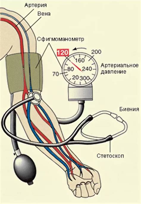 Что такое установочное давление?