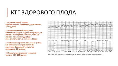 Что такое хорошее КТГ и как его достичь?