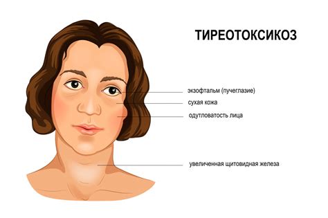 Щитовидка 1 степени: причины у женщин