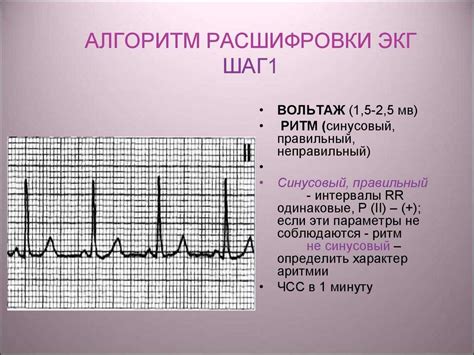 ЭКГ степень: значение и оценка состояния сердца