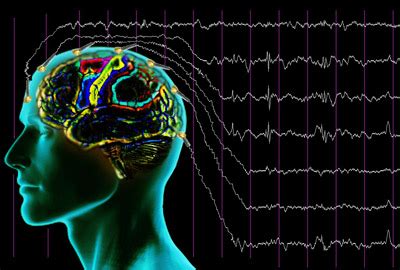 Электрическая активность мозга и дежавю