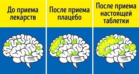 Эффект плацебо и благоприятный прогноз