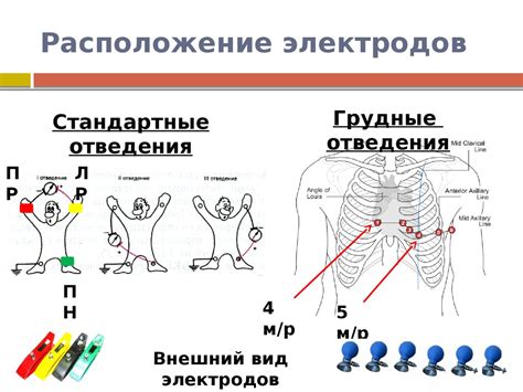  Возможности регистрации ЭКГ 