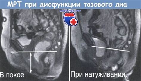  Диагностика и обследование при нарушении функции тазовых органов 