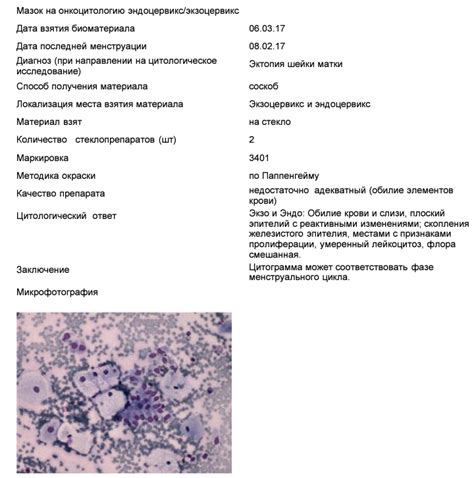  Как дифференцируется эхоструктура фолликулярного аппарата и почему это важно 