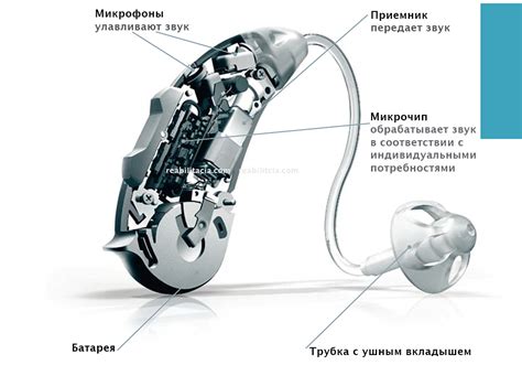  Механическое повреждение слухового аппарата 