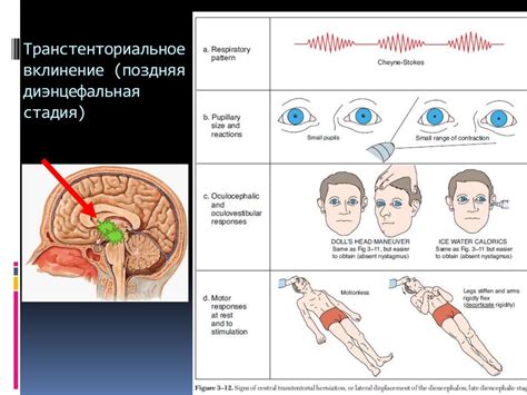  Основные признаки коматозного состояния 