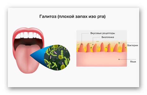  Основные причины неприятного запаха изо рта 