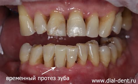  Популярные предрассудки и поверья о сновидениях с выпавшим зубом